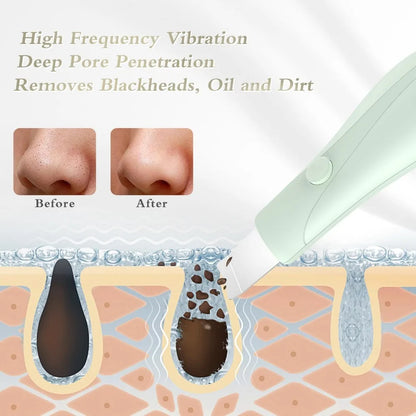 Electric Skin Scrubber Face Spatula