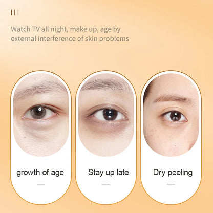 SADOER Vitamin C Eye Cream